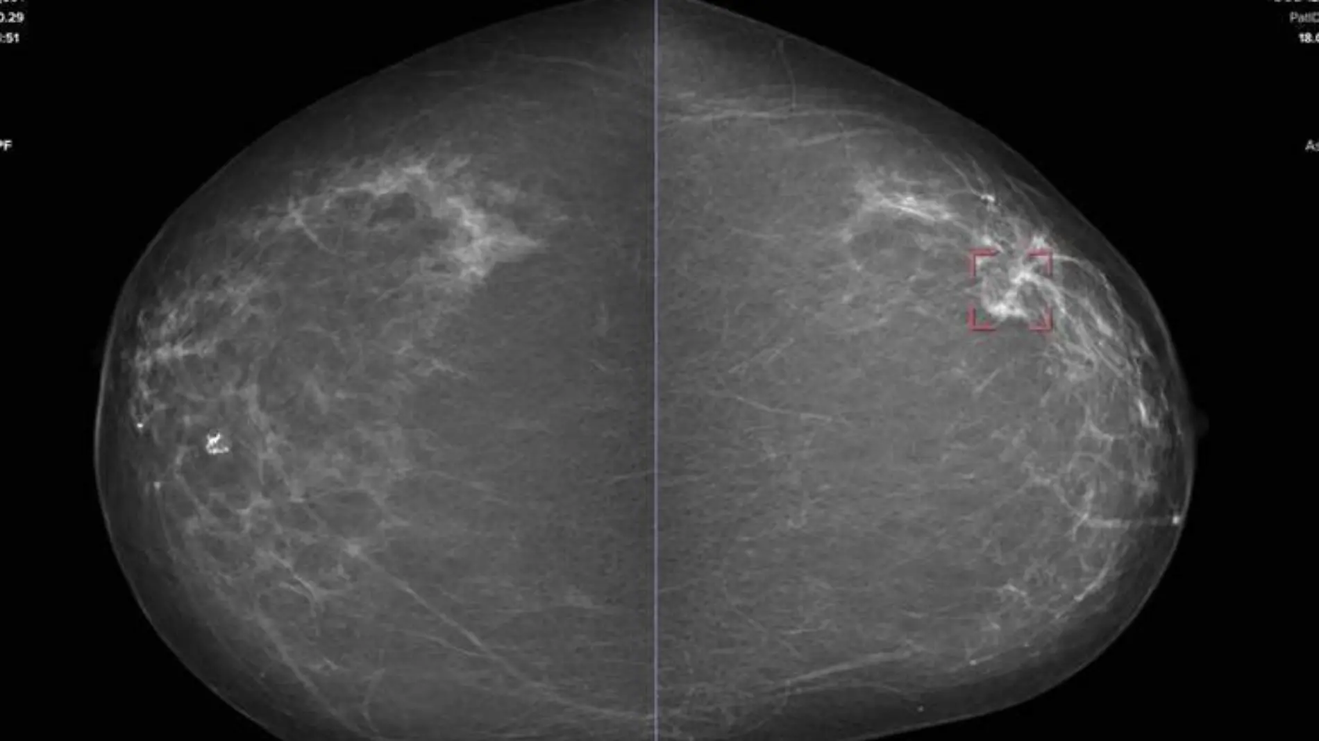 Uno de los principales enemigos de la ciencia es el cáncer